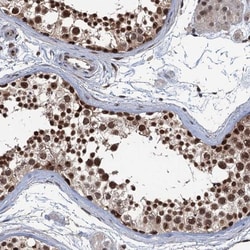 RASSF4 Antibody, Novus Biologicals 0.1mL; Unlabeled:Antibodies, Polyclonal