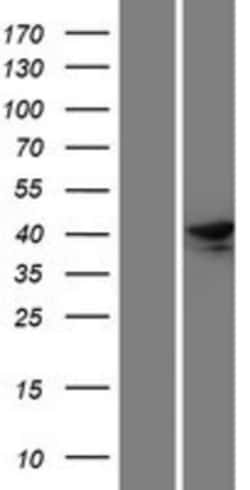 Novus Biologicals&trade;&nbsp;RASSF6 Overexpression Lysate