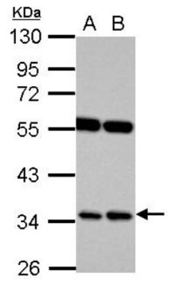 RASSF7 Antibody, Novus Biologicals 0.1mL; Unlabeled:Antibodies, Polyclonal