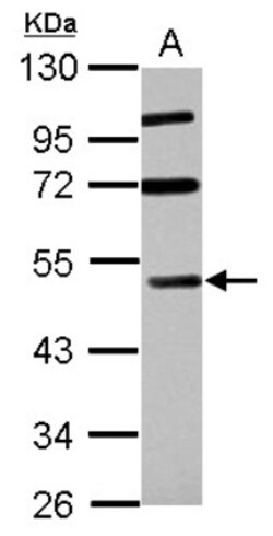 RASSF8 Antibody, Novus Biologicals 0.1mL; Unlabeled:Antibodies, Polyclonal