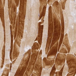 RAX2 Antibody, Novus Biologicals:Antibodies:Primary Antibodies