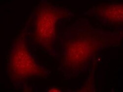 RB1, p Ser795 Antibody, Novus Biologicals:Antibodies:Primary Antibodies