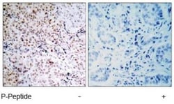 RB1, p Ser795 Antibody, Novus Biologicals:Antibodies:Primary Antibodies