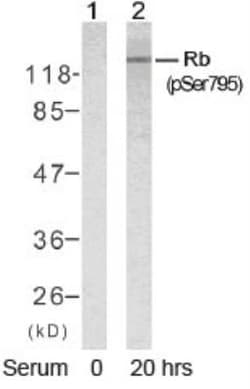 RB1, p Ser795 Antibody, Novus Biologicals:Antibodies:Primary Antibodies