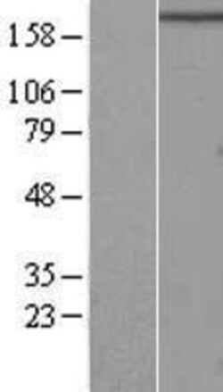 Novus Biologicals&trade;&nbsp;RB1CC1 Overexpression Lysate