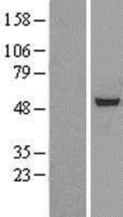 Novus Biologicals&trade;&nbsp;RbAp46 Overexpression Lysate