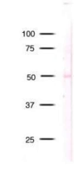 RBBP4/RbAp48 Antibody (13D10), Novus Biologicals 0.1mg; Unlabeled:Antibodies,