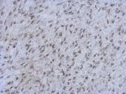RBBP4/RbAp48 Antibody (15G12), Novus Biologicals 0.1mg; Unlabeled:Antibodies,