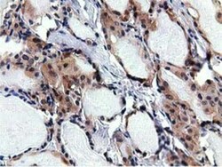 RBBP9 Antibody (OTI4G3), Novus Biologicals 0.1mL; Unlabeled:Antibodies,