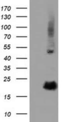 RBBP9 Antibody (OTI4G3), Novus Biologicals 0.1mL; Unlabeled:Antibodies,