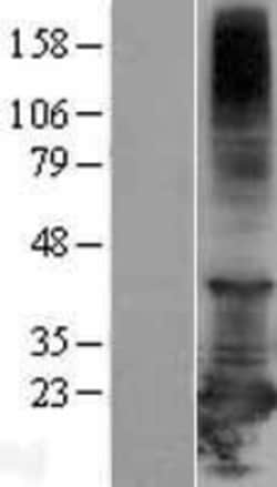Novus Biologicals&trade;&nbsp;RBBP9 Overexpression Lysate