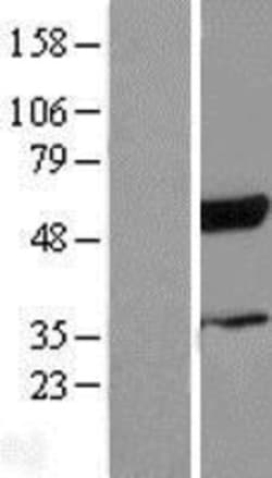 Novus Biologicals™ RBCK1 Overexpression Lysate