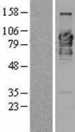 Novus Biologicals&trade;&nbsp;RBEL1 Overexpression Lysate