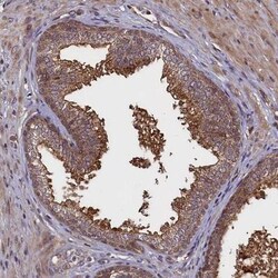 RBFA Antibody, Novus Biologicals:Antibodies:Primary Antibodies