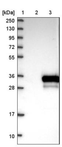 RBJ Antibody, Novus Biologicals 0.1mL; Unlabeled:Antibodies, Polyclonal