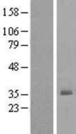 Novus Biologicals&trade;&nbsp;RBKS Overexpression Lysate
