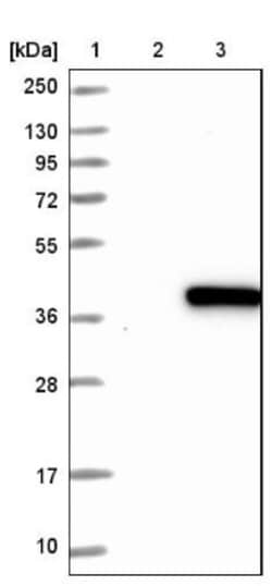 RBKS Antibody, Novus Biologicals 0.1mL; Unlabeled:Antibodies, Polyclonal