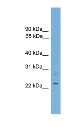 RBM11 Antibody, Novus Biologicals 100&mu;L; Unlabeled:Antibodies, Polyclonal