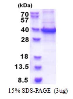 Novus Biologicals&trade;&nbsp;Recombinant Human RBM11 His Protein