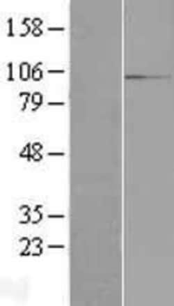 Novus Biologicals™ RBM12 Overexpression Lysate