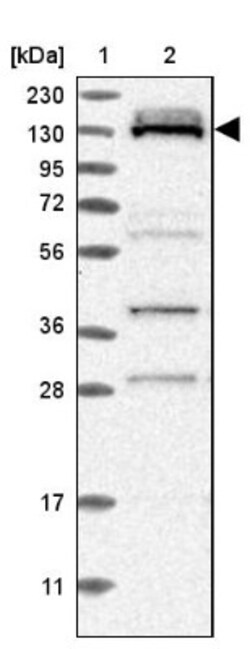 RBM12B Antibody, Novus Biologicals 25 &mu;L; Unlabeled:Antibodies, Polyclonal