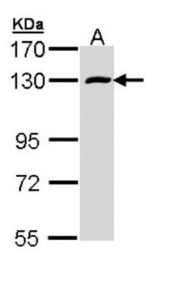 RBM15 Antibody, Novus Biologicals 0.1mL; Unlabeled:Antibodies, Polyclonal