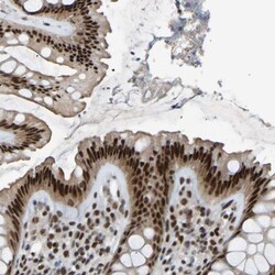 RBM15 Antibody, Novus Biologicals 0.1mL; Unlabeled:Antibodies, Polyclonal