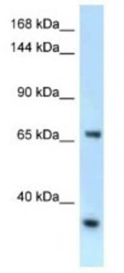 RBM15B Antibody, Novus Biologicals 100&mu;L; Unlabeled:Antibodies, Polyclonal