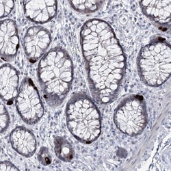 RBM15B Antibody, Novus Biologicals 25 &mu;L; Unlabeled:Antibodies, Polyclonal