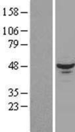 Novus Biologicals&trade;&nbsp;RBM17 Overexpression Lysate