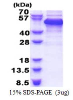 Novus Biologicals&trade;&nbsp;Recombinant Human RBM17 His Protein