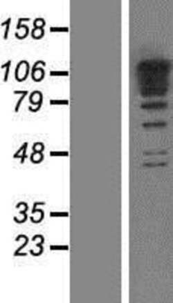 Novus Biologicals&trade;&nbsp;RBM19 Overexpression Lysate