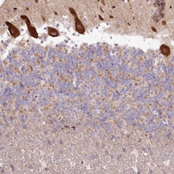 RBM20 Antibody, Novus Biologicals 25 &mu;L, Unlabeled:Antibodies, Polyclonal