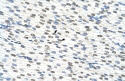RBM22 Antibody, Novus Biologicals 100&mu;L; Unlabeled:Antibodies, Polyclonal