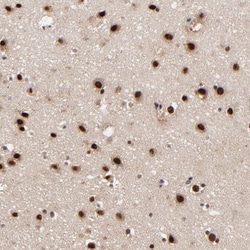 RBM22 Antibody, Novus Biologicals 0.1mL; Unlabeled:Antibodies, Polyclonal