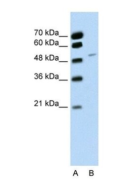 RBM22 Antibody, Novus Biologicals 100&mu;L; Unlabeled:Antibodies, Polyclonal