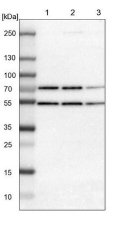 RBM22 Antibody, Novus Biologicals 0.1mL; Unlabeled:Antibodies, Polyclonal