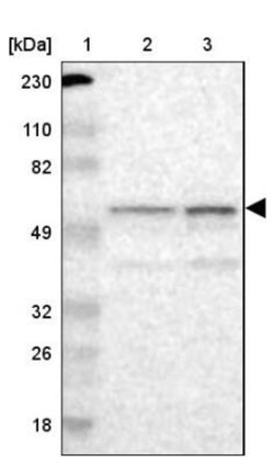 RBM23 Antibody, Novus Biologicals 25 &mu;L | Buy Online | Novus Biologicals | Fisher Scientific
