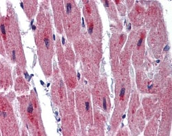 RBM24 Antibody, Novus Biologicals 0.05mg; Unlabeled:Antibodies, Polyclonal