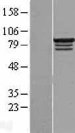 Novus Biologicals™ RBM28 Overexpression Lysate