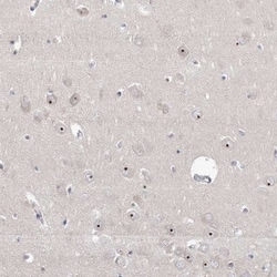 RBM28 Antibody, Novus Biologicals 25 &mu;L | Buy Online | Novus Biologicals | Fisher Scientific