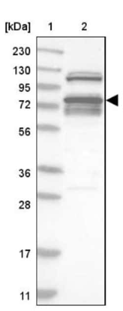 RBM28 Antibody, Novus Biologicals 25 &mu;L | Buy Online | Novus Biologicals | Fisher Scientific