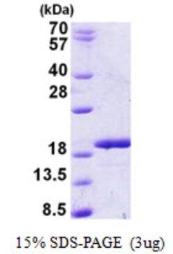 Novus Biologicals&trade;&nbsp;Recombinant Human RBM3 His Protein