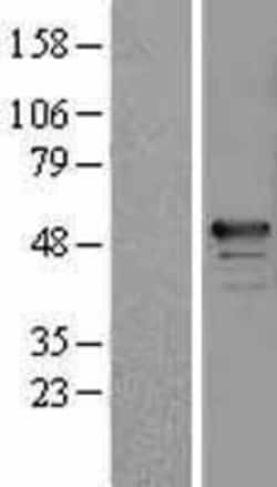 Novus Biologicals™ RBM34 Overexpression Lysate