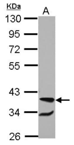 RBM4 Antibody, Novus Biologicals 0.1mL; Unlabeled:Antibodies, Polyclonal