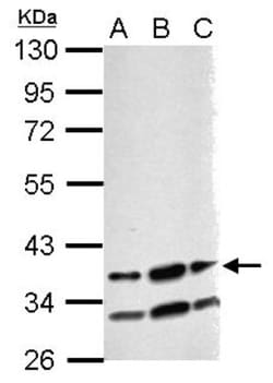 RBM4 Antibody, Novus Biologicals 0.1mL; Unlabeled:Antibodies, Polyclonal