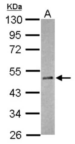 RBM41 Antibody, Novus Biologicals 0.1mL; Unlabeled:Antibodies, Polyclonal