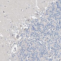 RBM43 Antibody, Novus Biologicals 0.1mL; Unlabeled:Antibodies, Polyclonal