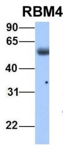 RBM4 Antibody, Novus Biologicals:Antibodies:Primary Antibodies