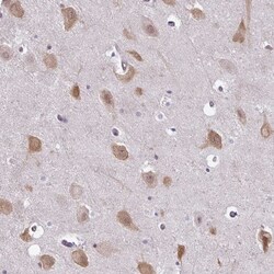 RBM4 Antibody, Novus Biologicals 25 &mu;L, Unlabeled:Anticorps, Polyclonal